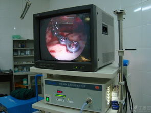 专利产品 内窥镜辅助新型穿颊器在颌面骨骨折内固定中的应用及计算机软硬件辅助系统集成